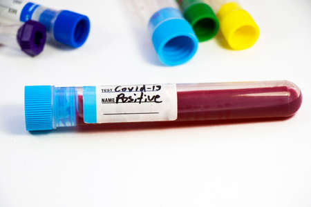 Corona virus positive blood test tubes on the white background, studio shoot. Blood test samples. Diagnosis and laboratory.の写真素材