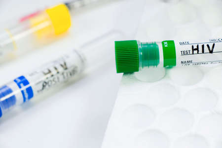 Hiv and aids infection test, doctors face and hand holding tube with blood on the blue background....
