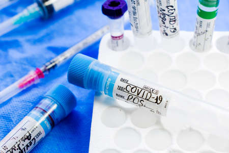 Corona virus and Covid-19 positive blood test tubes on the white background, studio shoot. Blood test samples. Diagnosis and laboratory.のeditorial素材