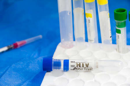 HIV and aids infection test, doctors face and hand holding tube with blood on the blue background....