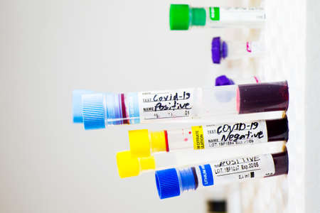 Corona virus and Covid-19 positive blood test tubes on the white background, studio shoot. Blood test samples. Diagnosis and laboratory.の写真素材