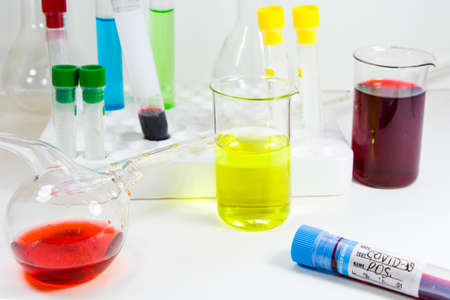 Corona virus and Covid-19 positive blood test tubes on the white background, studio shoot. Blood test samples. Diagnosis and laboratory. Chemical elements.の写真素材