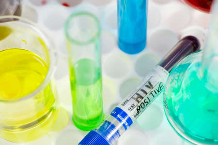 HIV blood test tube sample, aids immune viruses.の写真素材