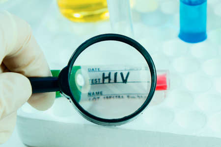 HIV blood test tube sample, aids immune viruses.の写真素材