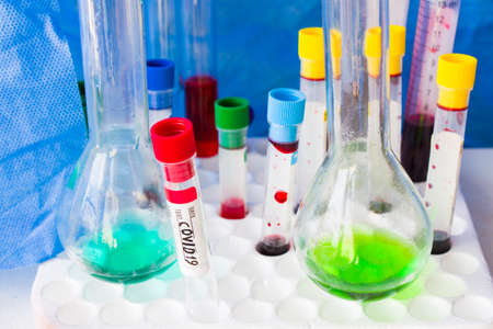Covid - 19 and corona virus blood test sample, negative and positive tests, reagents and glassware