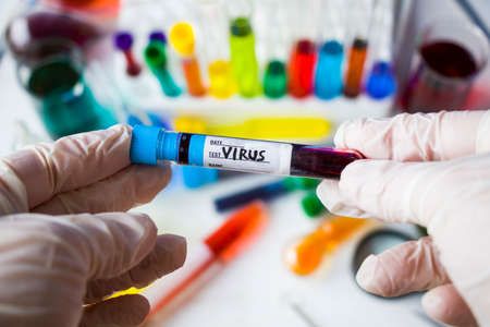 virus blood test tube in laboratory, glassware and reagents in labの写真素材