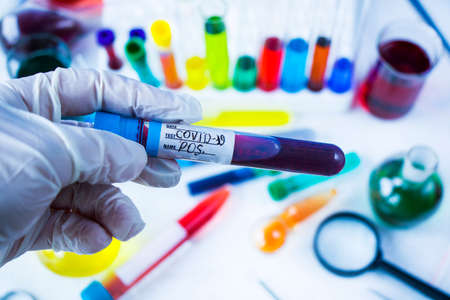 Corona virus, Covid - 19 positive blood test tube in laboratory, glassware and reagents in labの写真素材