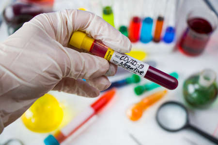 Corona virus, Covid - 19 negative blood test tube in laboratory, glassware and reagents in lab