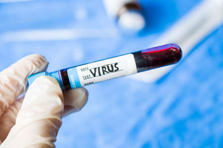 virus blood test tube in laboratory, glassware and reagents in labの写真素材