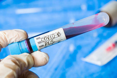 Corona virus positive blood test tubes on the white background, studio shoot. Blood test samples....