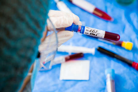 CBC 0305 blood test tube sample in doctors handの写真素材