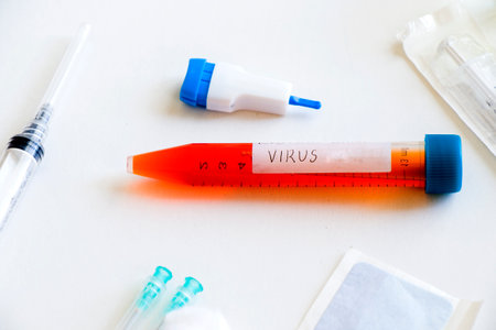 Mononucleosis and Epstein-barr virus blood test sample in lab on the white background, laboratory tableの写真素材
