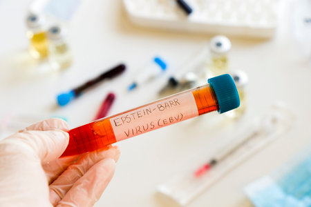Mononucleosis and Epstein-barr virus blood test sample in lab on the white background, laboratory tableの写真素材