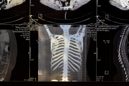 Magnetic computer tomography photo of women