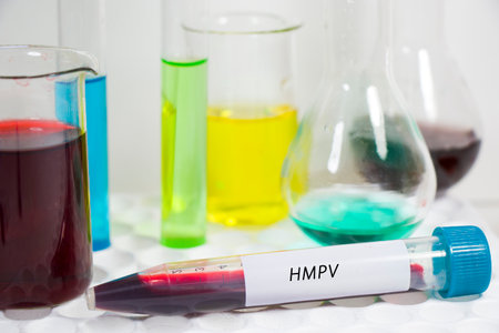 HMPV virus blood and other test in laboratoryの写真素材