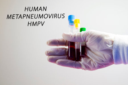 Human Metapneumovirus, HMPV virus test in labの写真素材