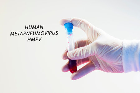 Human Metapneumovirus, HMPV virus test in labの写真素材