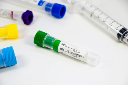 Human Metapneumovirus, HMPV virus test in labの写真素材