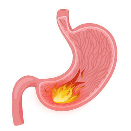 Stomach fire. Vector illustration, cartoon style, white backgroundのイラスト素材