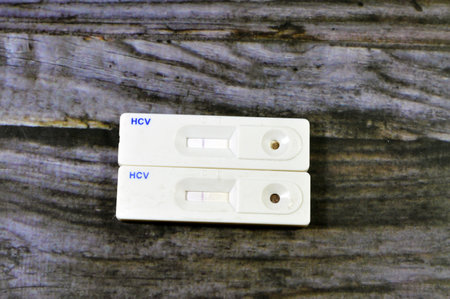 Negative test result of HCV blood sample rapid screening test, Hepatitis C is an infectious disease...