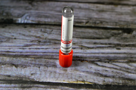 Cairo, Egypt, January 11 2024: Xinle Blood collection tube for collecting blood samples for laboratory analysis tests like CBC complete blood count, ESR, CRP, FBS, HbA1C, kidney and liver functionsのeditorial素材