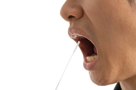 Man mouth with cotton swab. Saliva specimens. Antigen or Antibody test. Virus disease healthcare...