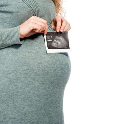Pregnant woman holding ultrasound picture, isolated on white backgroundの写真素材