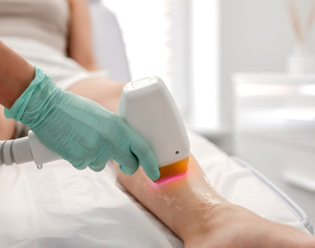 Master Of Laser Hair Removal Performs Procedure In Close-Upの写真素材