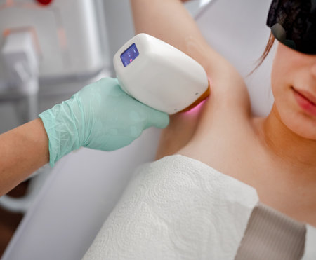 Master Conducts Laser Hair Removal Procedure For Client In Salonの写真素材