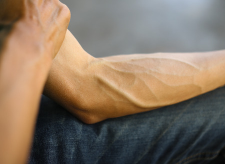 Arms full of tendons, Tendons on the forearmの写真素材