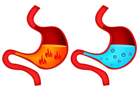 Heartburn and gastritis in the stomach, 3d renderingの写真素材