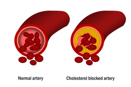 Cholesterol in artery. Medical concept, 3d renderingの写真素材