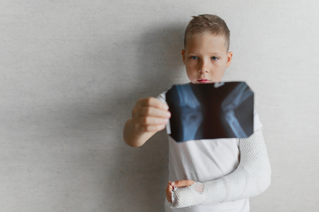 The boy with a broken hand looks at the X-ray. X-ray in the hands of a sad boy with a broken arm.の写真素材