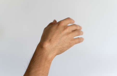 Ganglion cyst on mans hand on white background
