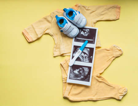 Ultrasound, pregnancy test and baby things on yellow backgroundの写真素材
