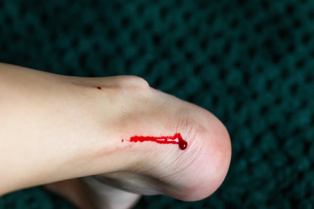 Close-up of a wounded leg with visible blood near the heel, caused by shaving. A realistic depiction of a common everyday injury, suitable for healthcare, safety, or personal care awareness visuals.の写真素材