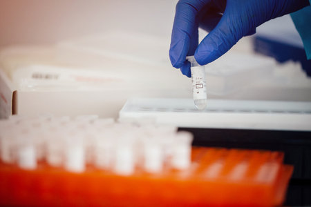 doctor in medical gloves holding test tube with covid-19 test