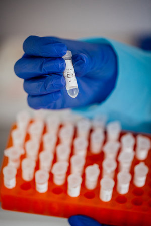 doctor in medical gloves holding test tube with covid-19 test