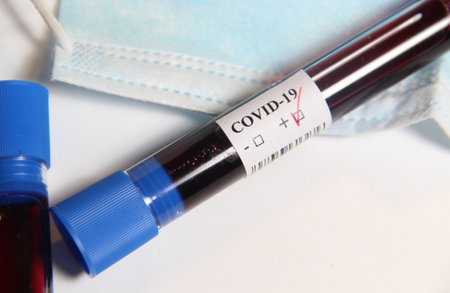 COVID-19  and doctor with blood test in her handの写真素材