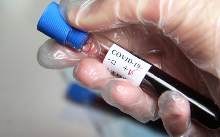 COVID-19  and doctor with blood test in her handの写真素材