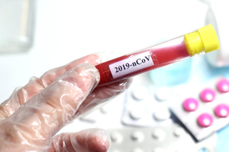 Coronavirus 2019, hygienic items, tube test and maskの写真素材