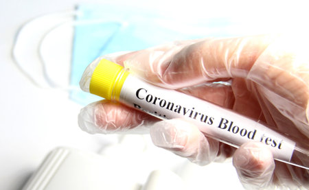 Corona virus 2019, hygienic items, tube test and mask