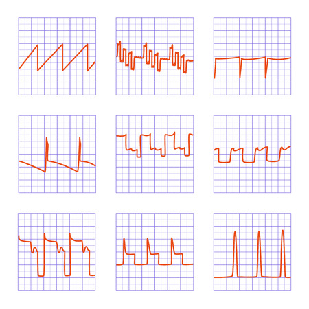 Set of nine different graphs.Diagrams of oscilloscope on checkered paper.のイラスト素材