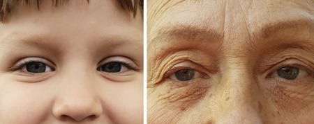 face old and young, aging, wrinkles, before and after