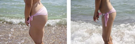 girl in a swimsuit slimming before and after a diet