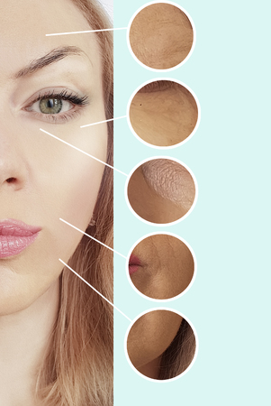 woman wrinkles face before and after procedures collageの写真素材