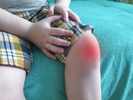 boy knee pain symptom infection, osteoarthritis conceptの写真素材