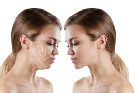 woman double chin before and after