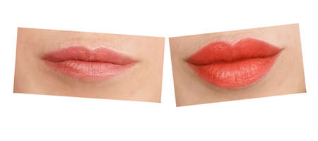 girl lips before and after augmentationの写真素材