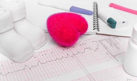 Electrocardiography, close-up. Notebook pregnant. The result of consulting a doctor.の写真素材